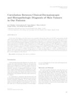 Correlation Between Clinical-Dermatoscopic and Histopathologic Diagnosis of Skin Tumors in Our Patients