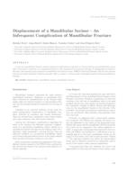 Displacement of a Mandibular Incisor – An Infrequent Complication of Mandibular Fracture