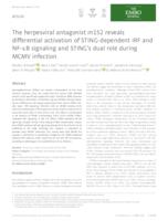 The herpesviral antagonist m152 reveals differential activation of STING‐dependent IRF and NF‐κB signaling and STING's dual role during MCMV infection