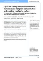 Tip of the iceberg: Immunohistochemical markers reveal malignant transformation underneath a vocal polyp surface