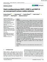 "Matrix metalloproteinases MMP-1, MMP-2, and MMP-13 are overexpressed in primary nodular melanoma"