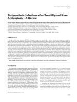 prikaz prve stranice dokumenta Periprosthetic Infections after Total Hip and Knee Arthroplasty – A Review