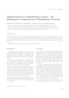 prikaz prve stranice dokumenta Displacement of a Mandibular Incisor – An Infrequent Complication of Mandibular Fracture