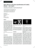 prikaz prve stranice dokumenta Psoas abscess as the first manifestation of Crohn’s disease – case report
