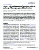 prikaz prve stranice dokumenta NK/ILC1 cells mediate neuroinflammation and brain pathology following congenital CMV infection