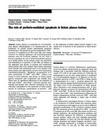 prikaz prve stranice dokumenta The role of perforin-mediated apoptosis in lichen planus lesions