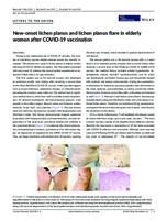 prikaz prve stranice dokumenta New‐onset lichen planus and lichen planus flare in elderly women after                                       Covid  ‐19 vaccination