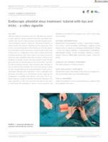 prikaz prve stranice dokumenta Endoscopic pilonidal sinus treatment: tutorial with tips and tricks – a video vignette
