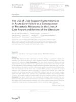 prikaz prve stranice dokumenta The Use of Liver Support System Devices in Acute Liver Failure as a Consequence of Metastatic Melanoma in the Liver: A Case Report and Review of the Literature